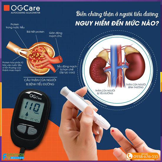 Máy đo đường huyết OG Care của BSI - Italia